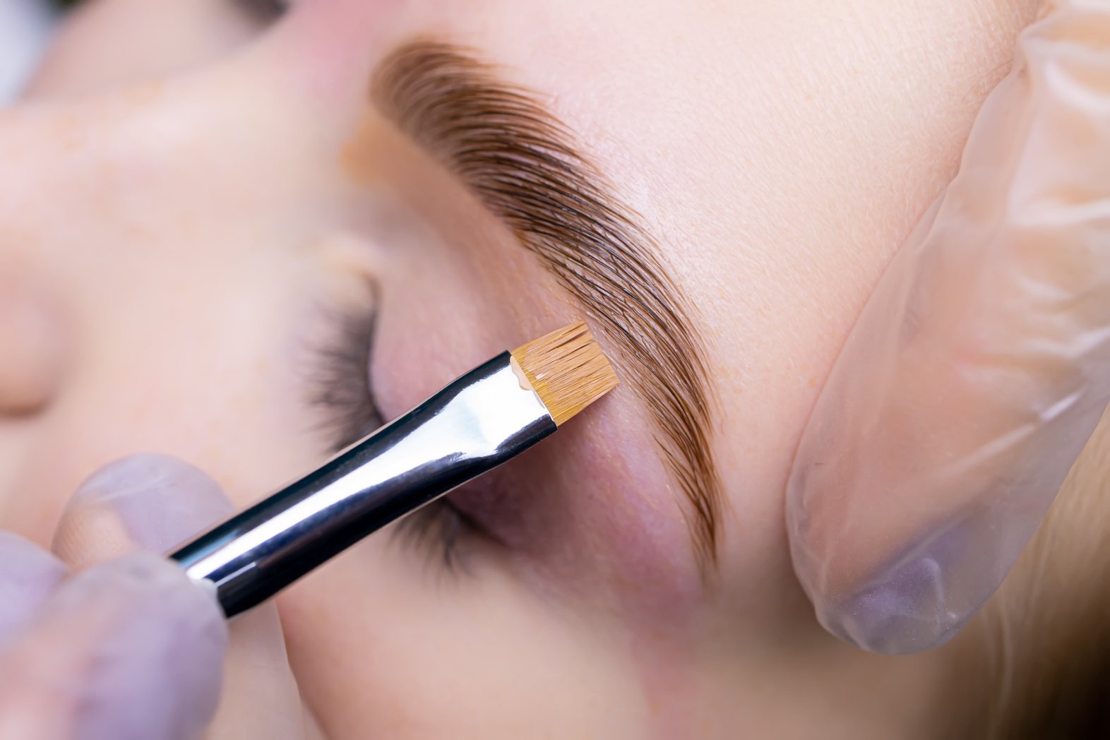 Close-up of the Eyebrow after the Lamination Procedure, the Mast